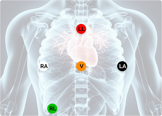 chest x-ray