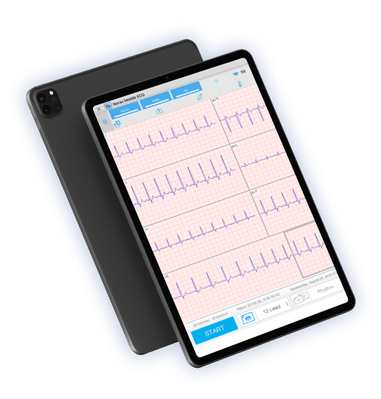 ECG analysis system for smartphones and tablets