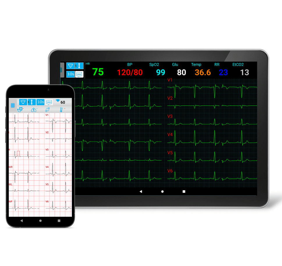 ECG analysis system for smartphones and tablets