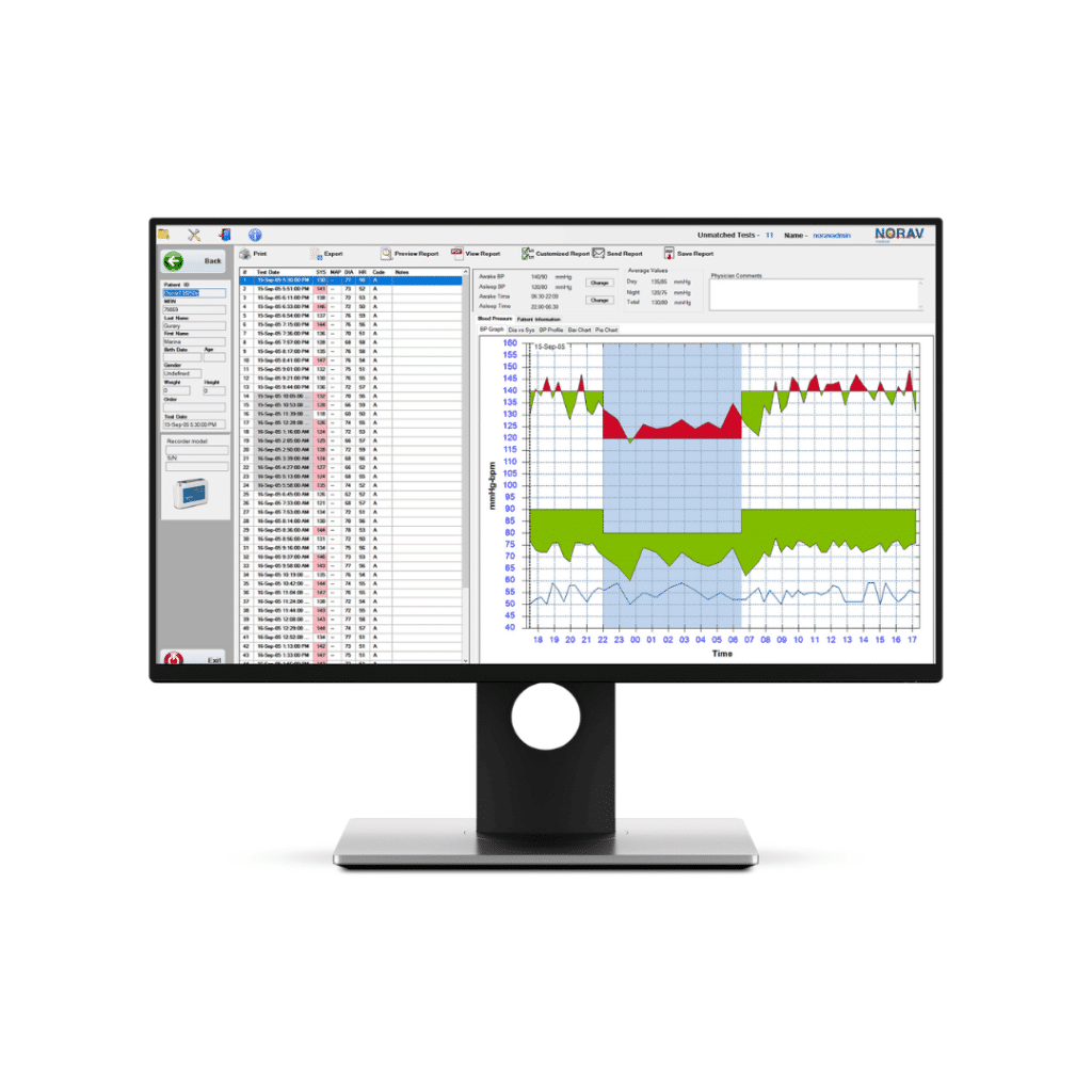 NEMS-A - ECG Management System