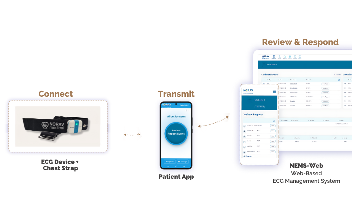 TeleEVENT event recorder ECG device